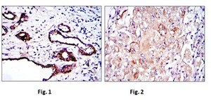 Anti-PKN2, clone 1D1 Antibody ascites fluid, clone 1D1, from mouse