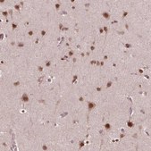 Anti-NFAT5 antibody produced in rabbit Prestige Antibodies&#174; Powered by Atlas Antibodies, affinity isolated antibody, buffered aqueous glycerol solution