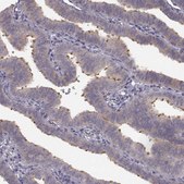 Anti-SPAG17 antibody produced in rabbit Prestige Antibodies&#174; Powered by Atlas Antibodies, affinity isolated antibody, buffered aqueous glycerol solution, ab1
