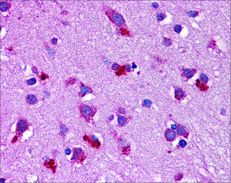 Anti-WNT7B antibody produced in rabbit affinity isolated antibody