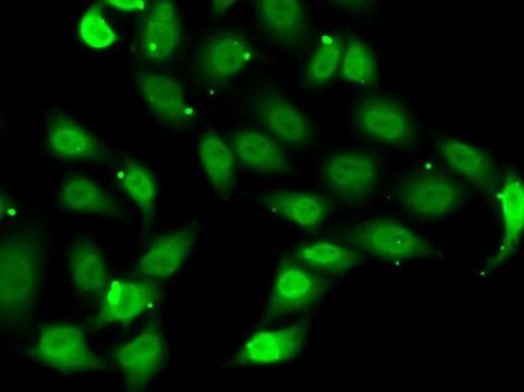 Anti-TEAD1 antibody produced in rabbit