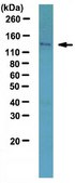 Anti-HDAC4 Antibody serum, from rabbit