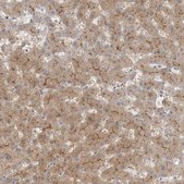 Anti-MAT2B antibody produced in rabbit Prestige Antibodies&#174; Powered by Atlas Antibodies, affinity isolated antibody, buffered aqueous glycerol solution