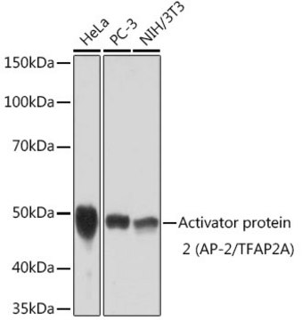 Anti-Activator protein 2 (AP-2/TFAP2A) Antibody, clone 8I8E4, Rabbit Monoclonal