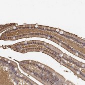 Anti-ADA antibody produced in rabbit Prestige Antibodies&#174; Powered by Atlas Antibodies, affinity isolated antibody, buffered aqueous glycerol solution
