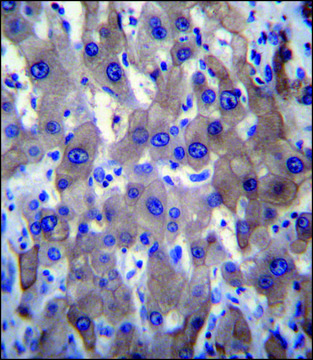 ANTI-MLXIPL (C-TERM) antibody produced in rabbit IgG fraction of antiserum, buffered aqueous solution