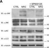 Anti-LC3B antibody produced in rabbit ~1&#160;mg/mL, affinity isolated antibody, buffered aqueous solution