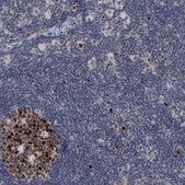 Anti-KIF18B antibody produced in rabbit Prestige Antibodies&#174; Powered by Atlas Antibodies, affinity isolated antibody, buffered aqueous glycerol solution