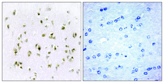Anti-HMG17 antibody produced in rabbit affinity isolated antibody