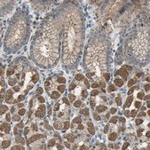 Anti-TRAK1 antibody produced in rabbit Prestige Antibodies&#174; Powered by Atlas Antibodies, affinity isolated antibody, buffered aqueous glycerol solution