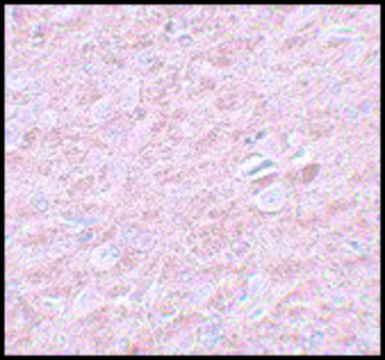 Anti-PRDM16 antibody produced in rabbit affinity isolated antibody