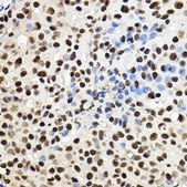 Anti- HIF1&#945; antibody produced in rabbit