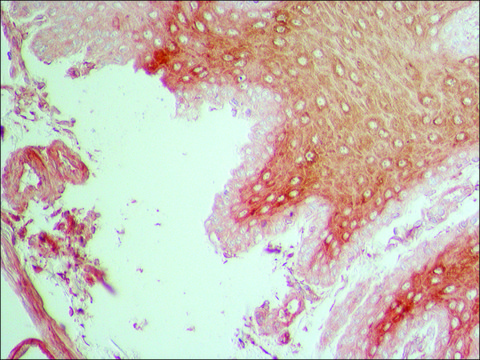 Anti-Fibroblast Growth Factor Receptor-1 antibody produced in rabbit ~1&#160;mg/mL, affinity isolated antibody, buffered aqueous solution