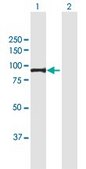 Anti-PFKM antibody produced in mouse purified immunoglobulin, buffered aqueous solution