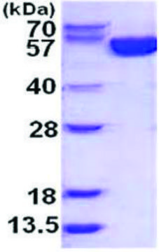 G6PD human recombinant, expressed in E. coli, &#8805;95% (SDS-PAGE)