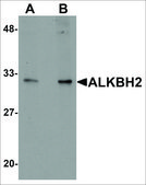 Anti-ALKBH2 antibody produced in rabbit affinity isolated antibody, buffered aqueous solution