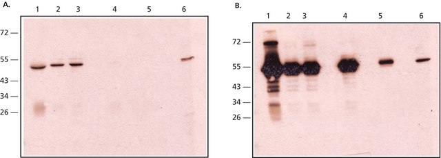 Anti-Rabbit IgG, Native antibody, Mouse monoclonal clone RabT-50, purified from hybridoma cell culture