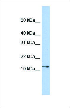 Anti-GNGT2 antibody produced in rabbit affinity isolated antibody