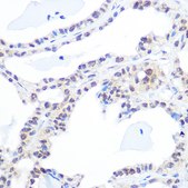 Anti-DNA topoisomerase I (TOP1) Antibody, clone 3D4W6, Rabbit Monoclonal