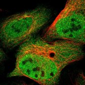 Anti-VCP antibody produced in rabbit Prestige Antibodies&#174; Powered by Atlas Antibodies, affinity isolated antibody, buffered aqueous glycerol solution