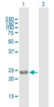 Anti-EDN1 antibody produced in mouse purified immunoglobulin, buffered aqueous solution