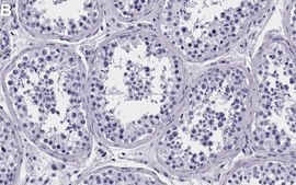 Anti-Sin3A Antibody, clone 1C4 ZooMAb&#174; Rabbit Monoclonal recombinant, expressed in HEK 293 cells