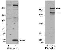 Anti-acetyl-Lysine Antibody, clone 4G12 clone 4G12, Upstate&#174;, from mouse
