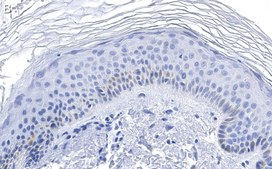 Anti-RXR-alpha Antibody, clone 2I8 ZooMAb&#174; Rabbit Monoclonal recombinant, expressed in HEK 293 cells