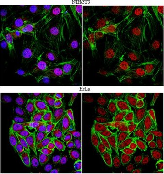 Anti-FoxP1 Antibody serum, from rabbit