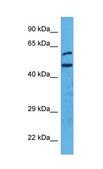 Anti-IRF4 antibody produced in rabbit affinity isolated antibody