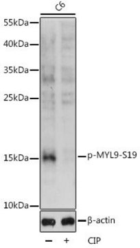 Anti-Phospho-MYL9-S19 antibody produced in rabbit