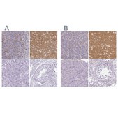 Anti-SLC17A7 antibody produced in rabbit Prestige Antibodies&#174; Powered by Atlas Antibodies, affinity isolated antibody, buffered aqueous glycerol solution