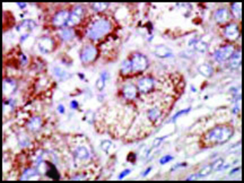 Anti-PFKFB4 (center) antibody produced in rabbit IgG fraction of antiserum, buffered aqueous solution