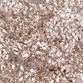 Monoclonal Anti-Adam10 Antibody Produced In Mouse Prestige Antibodies&#174; Powered by Atlas Antibodies, clone CL13809, affinity isolated antibody, buffered aqueous glycerol solution