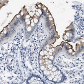 Anti-CEACAM5 antibody produced in rabbit Prestige Antibodies&#174; Powered by Atlas Antibodies, affinity isolated antibody, buffered aqueous glycerol solution