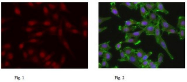 Anti-TIF1-alpha Antibody from rabbit, purified by affinity chromatography