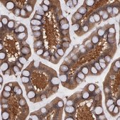 Anti-SYK antibody produced in rabbit Prestige Antibodies&#174; Powered by Atlas Antibodies, affinity isolated antibody, buffered aqueous glycerol solution