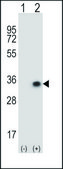 ANTI-CNOT8 (C-TERM) antibody produced in rabbit IgG fraction of antiserum, buffered aqueous solution