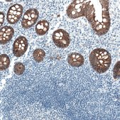 Monoclonal Anti-OCLN antibody produced in mouse Prestige Antibodies&#174; Powered by Atlas Antibodies, clone CL1555, purified immunoglobulin, buffered aqueous glycerol solution