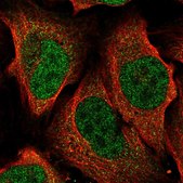 Anti-ATP6V1A antibody produced in rabbit Prestige Antibodies&#174; Powered by Atlas Antibodies, affinity isolated antibody