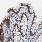 Anti-RBM47 antibody produced in rabbit Prestige Antibodies&#174; Powered by Atlas Antibodies, affinity isolated antibody, buffered aqueous glycerol solution