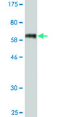 Monoclonal Anti-STEAP1 antibody produced in mouse clone 4F6-1F3, ascites fluid