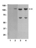 Anti-phospho-BMK1/Erk5 (Thr218/Tyr220) Antibody Upstate&#174;, from rabbit