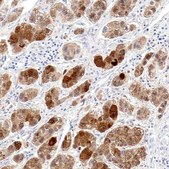 Anti-OTC antibody produced in rabbit Prestige Antibodies&#174; Powered by Atlas Antibodies, affinity isolated antibody, buffered aqueous glycerol solution