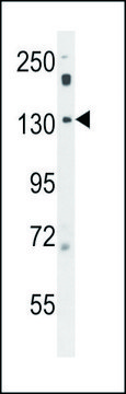 ANTI-POTEF (CENTER) antibody produced in rabbit IgG fraction of antiserum, buffered aqueous solution