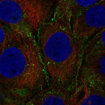 Anti-Lep Antibody Produced In Rabbit Prestige Antibodies&#174; Powered by Atlas Antibodies, affinity isolated antibody, buffered aqueous glycerol solution