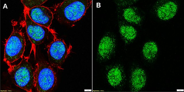 Anti-SETD5 Antibody, clone 3B22 ZooMAb&#174; Rabbit Monoclonal recombinant, expressed in HEK 293 cells