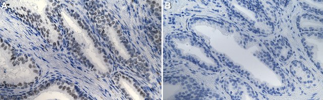 Anti-BRG1/SMARCA4 Antibody, clone 20C3.2 ZooMAb&#174; Mouse Monoclonal recombinant, expressed in HEK 293 cells