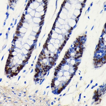 Anti-SOX9 antibody produced in rabbit