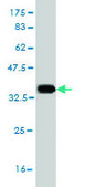 Monoclonal Anti-SLC6A19 antibody produced in mouse clone 4F11, purified immunoglobulin, buffered aqueous solution